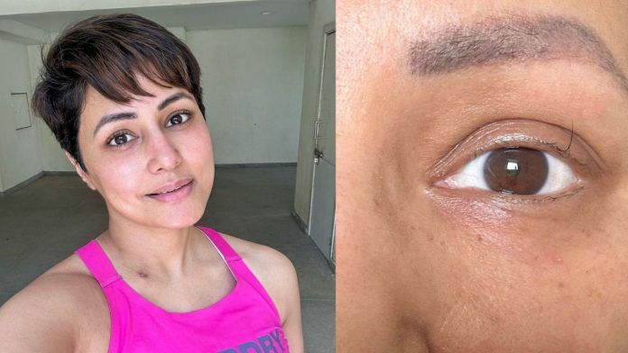 Hina Khan's Brave Battle with Breast Cancer: Finding Strength in Resilience